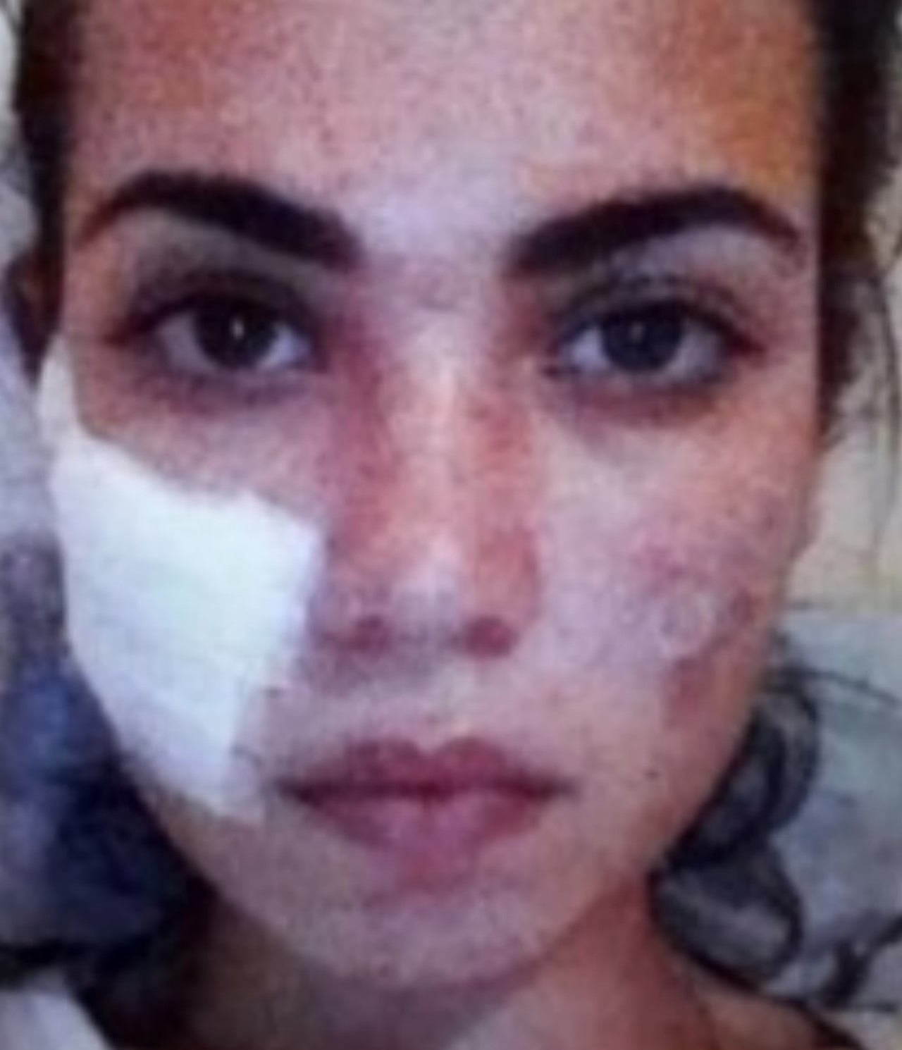 Miss Universo mostro como se le desfiguro el rostro tras una cirugia2